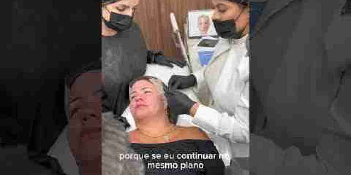 El peeling sirve para eliminar cicatrices y manchas